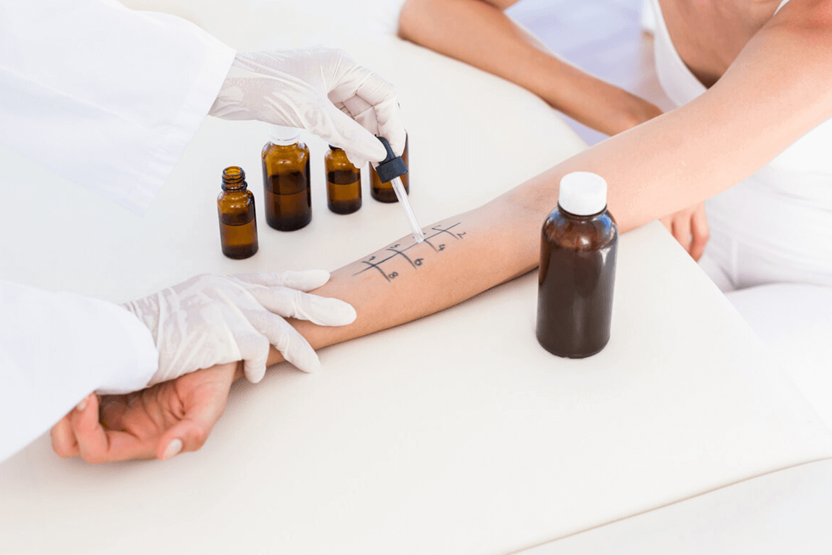 close up of person getting an allergy test on their arm